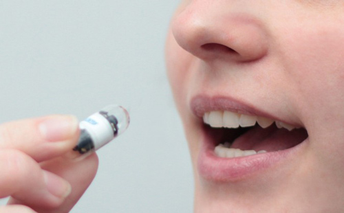 Капсульная эндоскопия