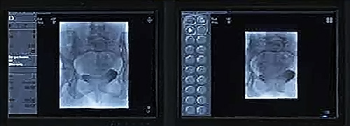 Лаборатория интервенционной радиологии и ангиографии.