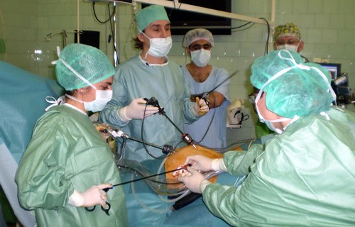 Пластика желудка